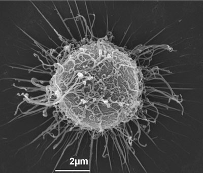 Microscopia eletrônica de varredura mostrando os aspectos morfológicos do fungo C. neoformans, um dos agentes causadores da criptococose humana. Cortesia de Caroline L. Ramos, Mestra em Ciências pelo Instituto de Microbiologia da UFRJ (2011)